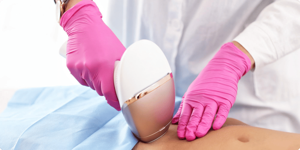 Adoptez l'épilation laser comme votre allié beauté