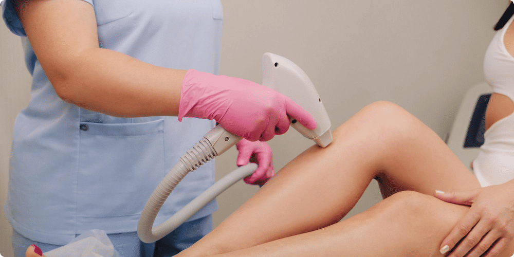 Comment fonctionne l'épilation laser ?