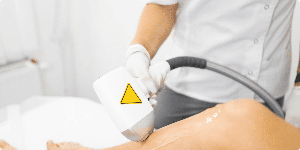 L'épilation laser des jambes : guide complet
