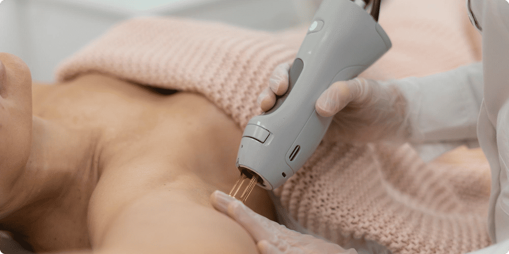 Comparatif des meilleurs modèles d'épilateurs laser